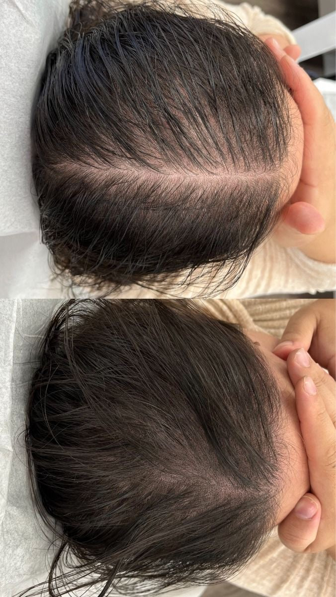🌿 The Ordinary Multi-Peptide Serum for Hair Density