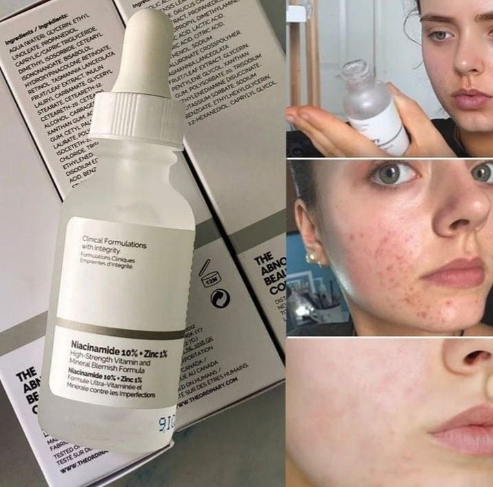 💧 The Ordinary Niacinamide 10% + Zinc 1%
