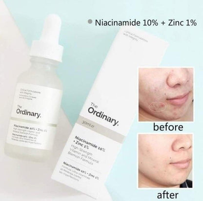 💧 The Ordinary Niacinamide 10% + Zinc 1%